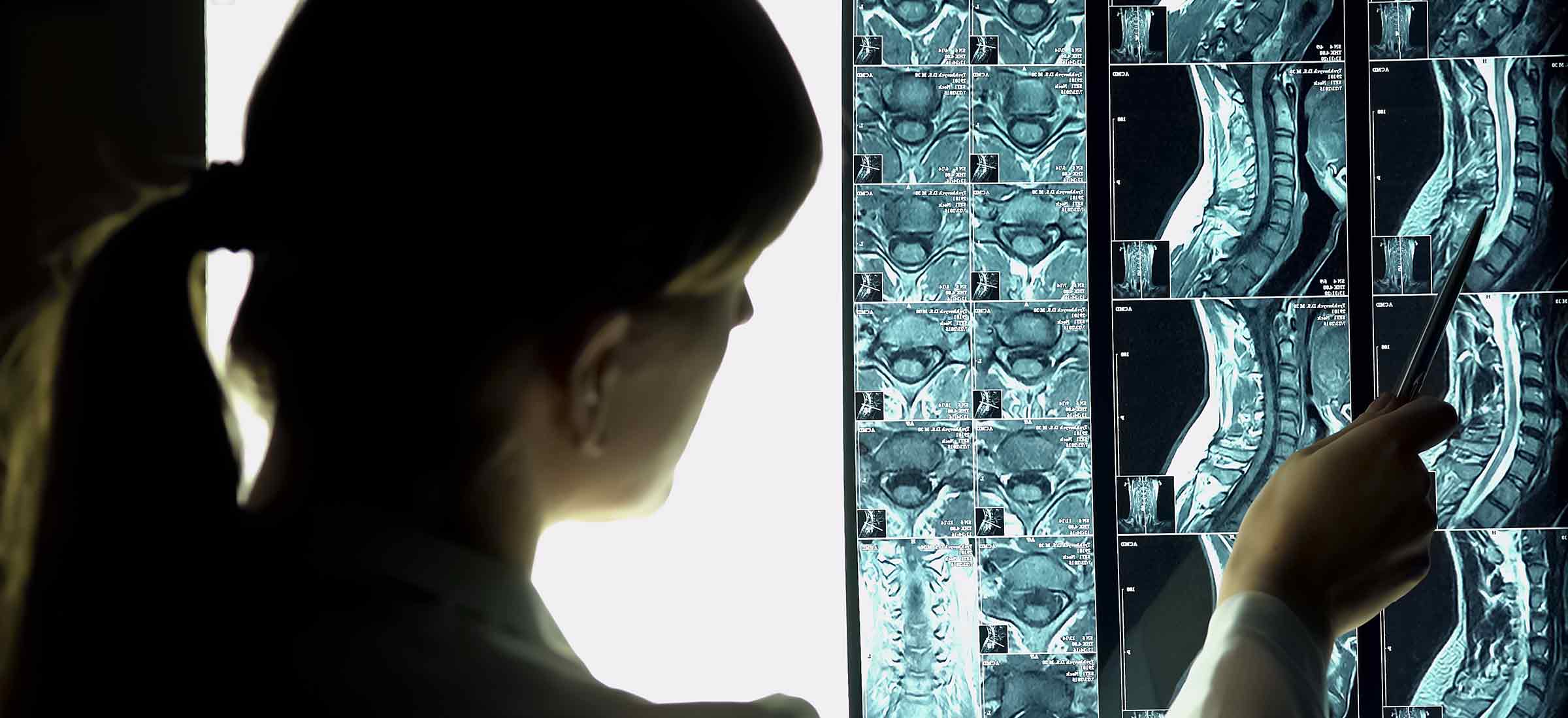 Surgeon looking at patient neck x-ray for a spine injury treatment.