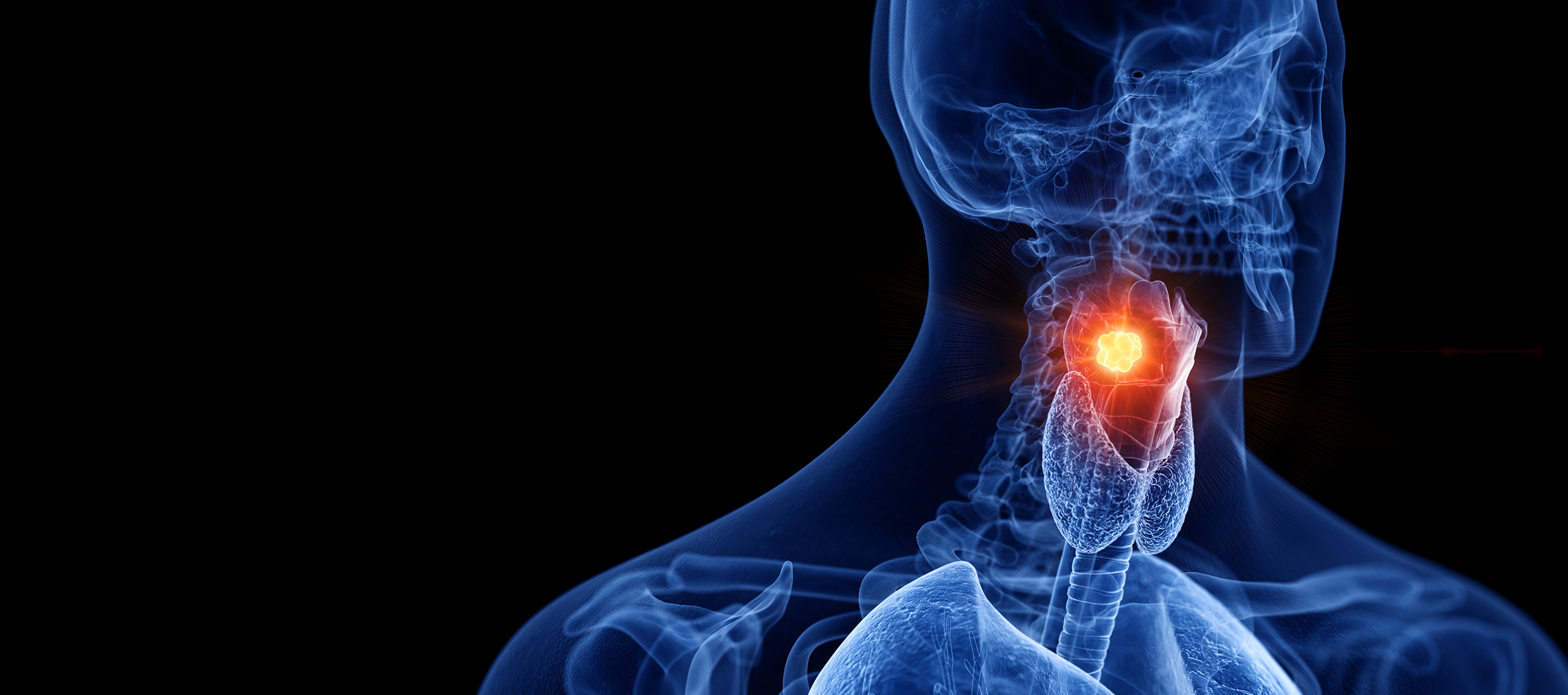 A rendering of a human head and throat in blue and an epiglottis and larynx in red and yellow is shown on a black background