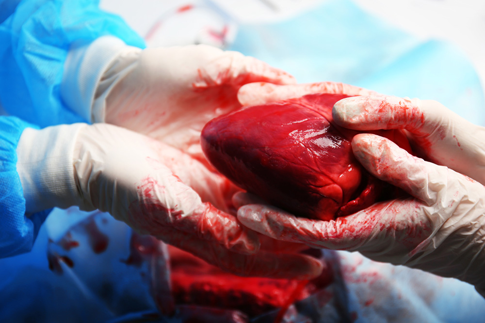 Why Heart Transplants Are So Rewarding and So Challenging Today